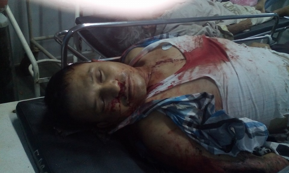 congress duwarika shresth dead